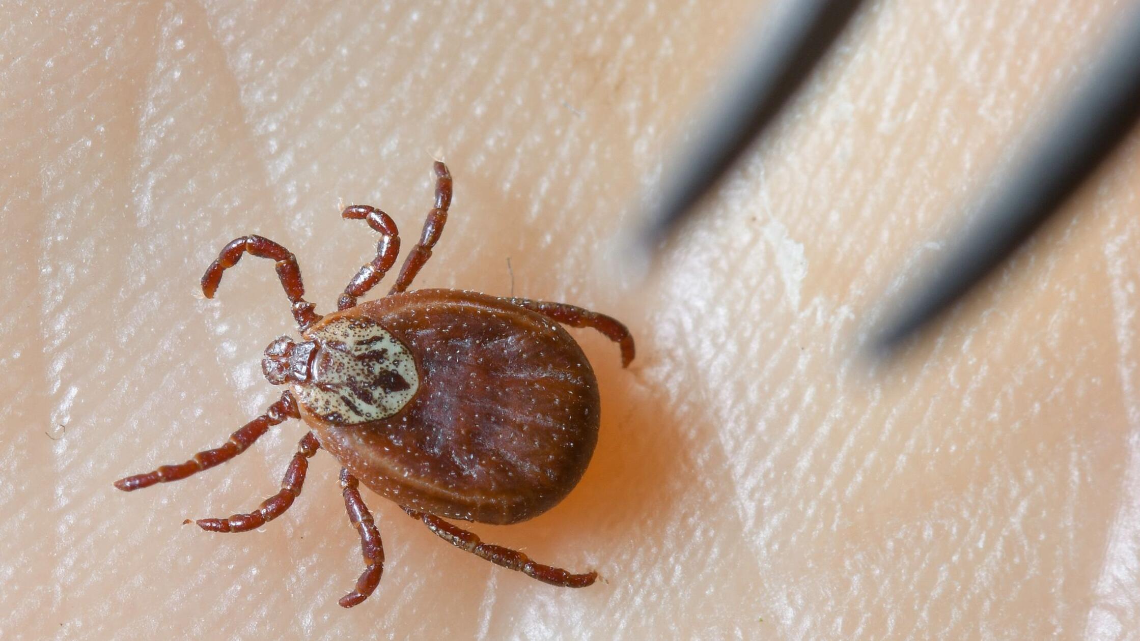 Durch Zecken übertragen: Borreliose-Fälle nehmen weiter zu – Jetzt schon 1000 mehr als 2024