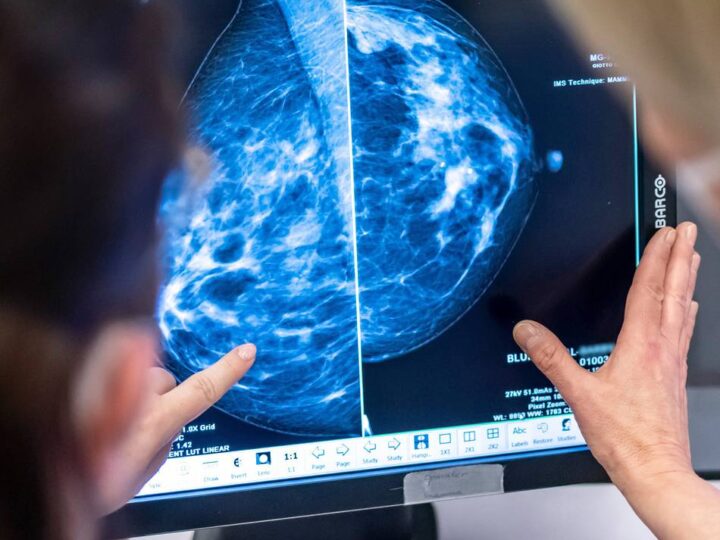 Hilfe für Patientinnen und Patienten in Hilden und Umgebung: Schockdiagnose Brustkrebs – wie geht es weiter?