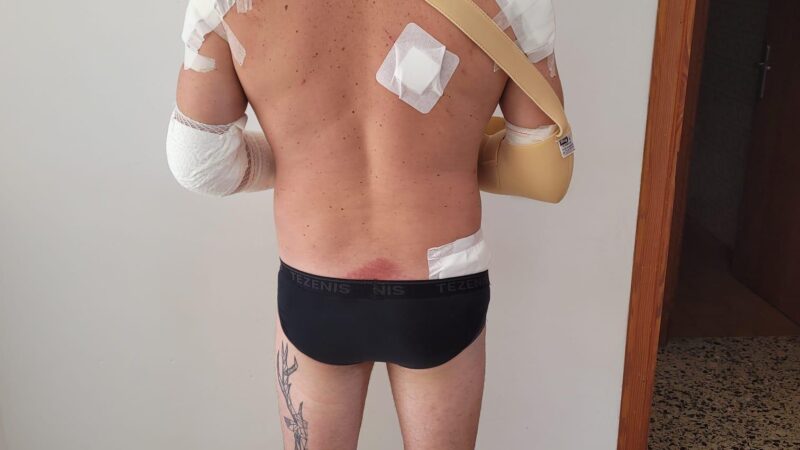 „Schutzengel gibt es wirklich“: Deutsche retten Motorradfahrer auf Mallorca das Leben