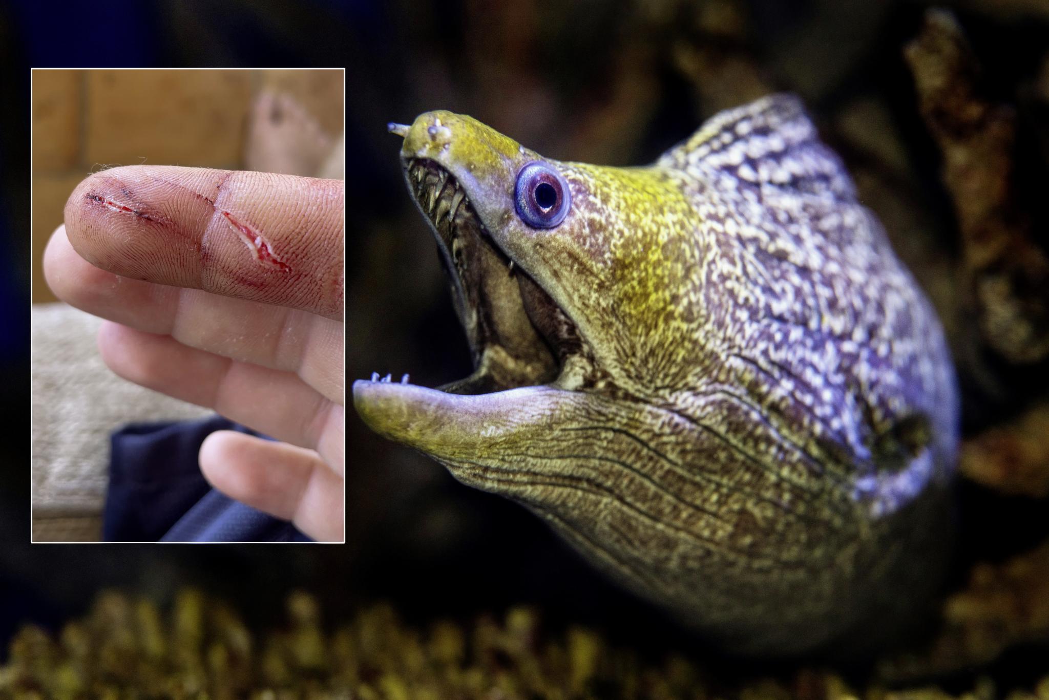 Vier tiefe Bisswunden: Deutscher Mallorca-Resident wird beim Angeln von Muräne attackiert