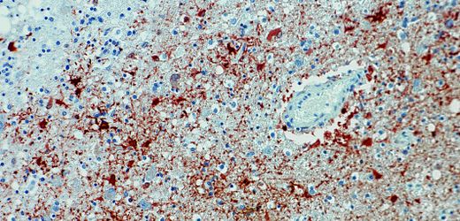Bayern: Erneuter Todesfall durch Borna-Virus