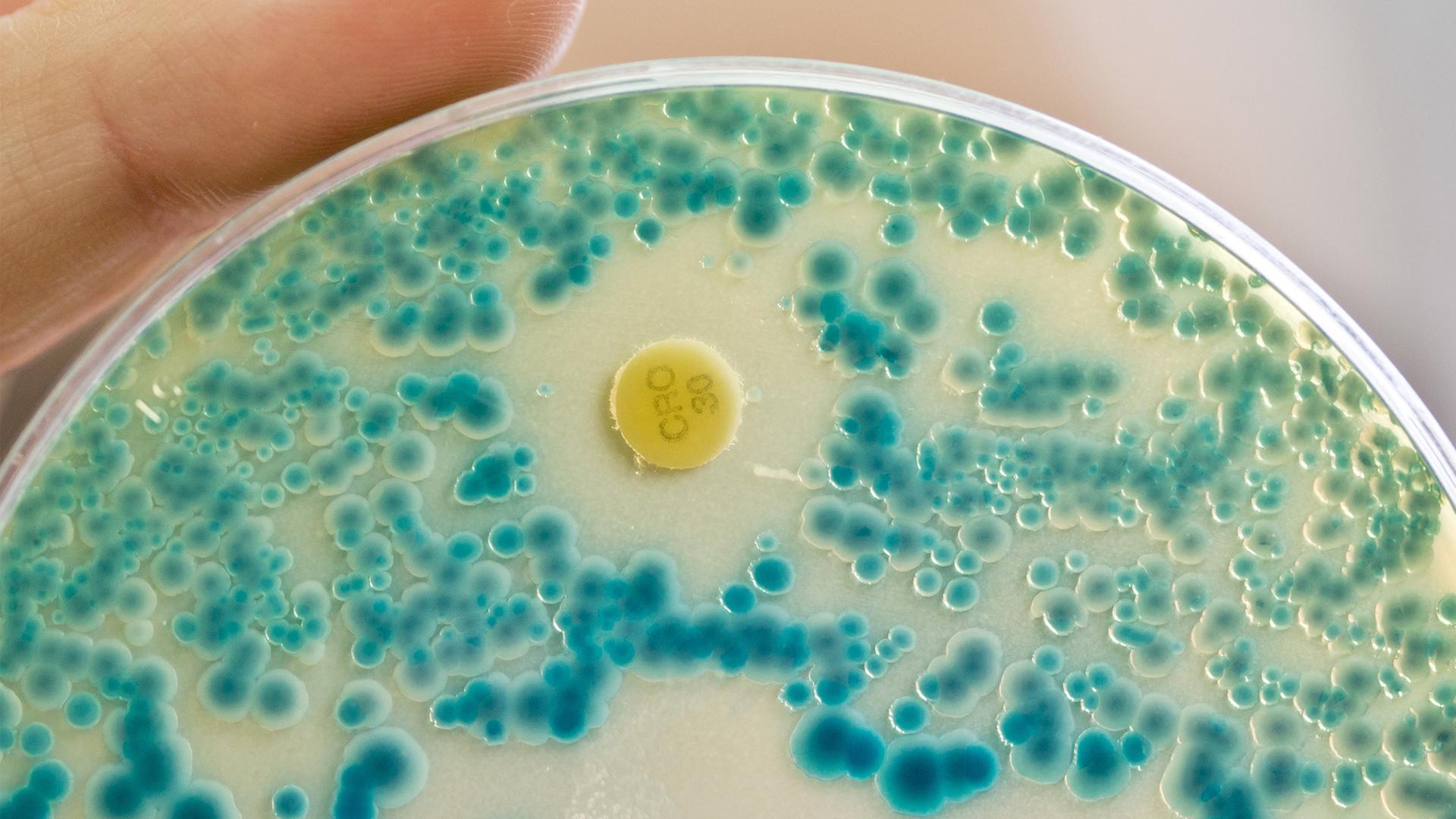 Warnung der WHO: Immer mehr Antibiotika wirken nicht mehr