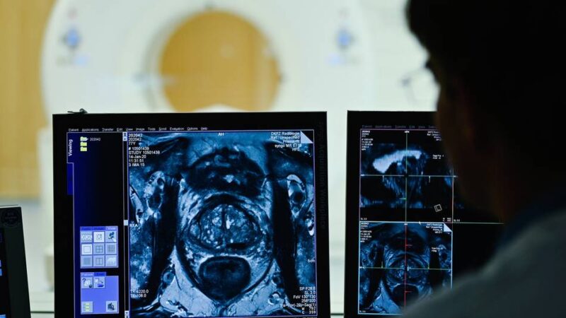 Kein Abtasten mehr nötig: „Gehen jetzt endlich mehr Männer zur Prostata-Vorsorge, Herr Doktor?“