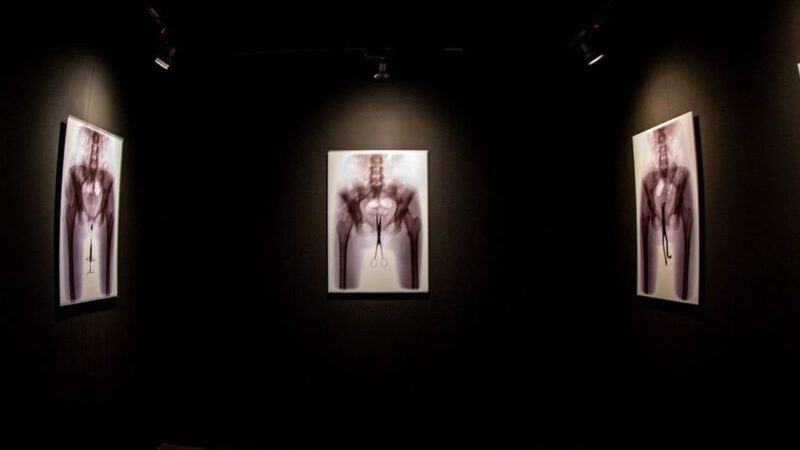 Von Masthuhn bis Monroe: Wie Röntgenstrahlen die Sicht auf Mensch und Welt verändert haben