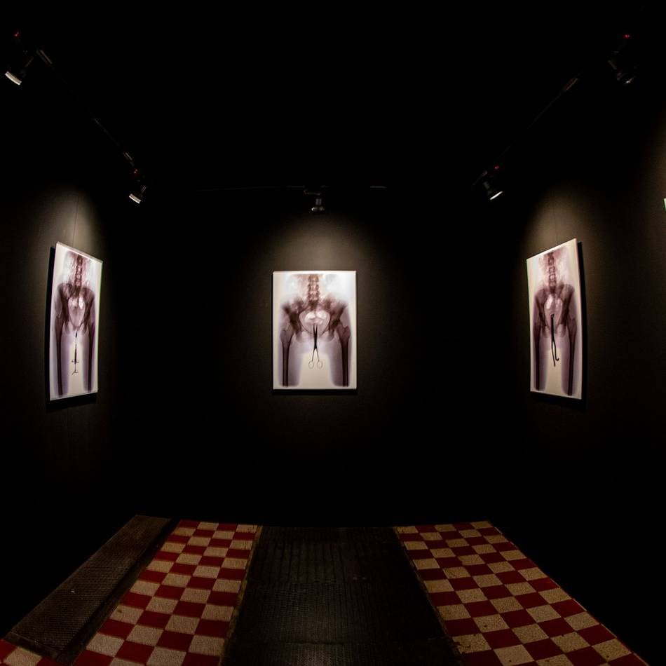 Von Masthuhn bis Monroe: Wie Röntgenstrahlen die Sicht auf Mensch und Welt verändert haben