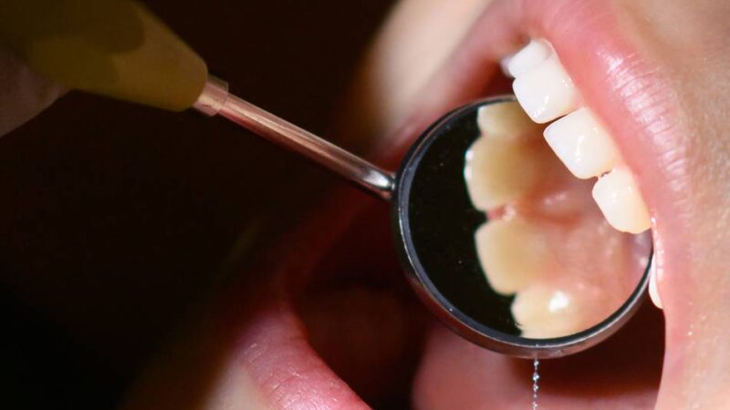 Zahngesundheit von Kindern in NRW: „Schwarzes Loch“ – Ministerium fehlen Daten über Vorsorgetermine